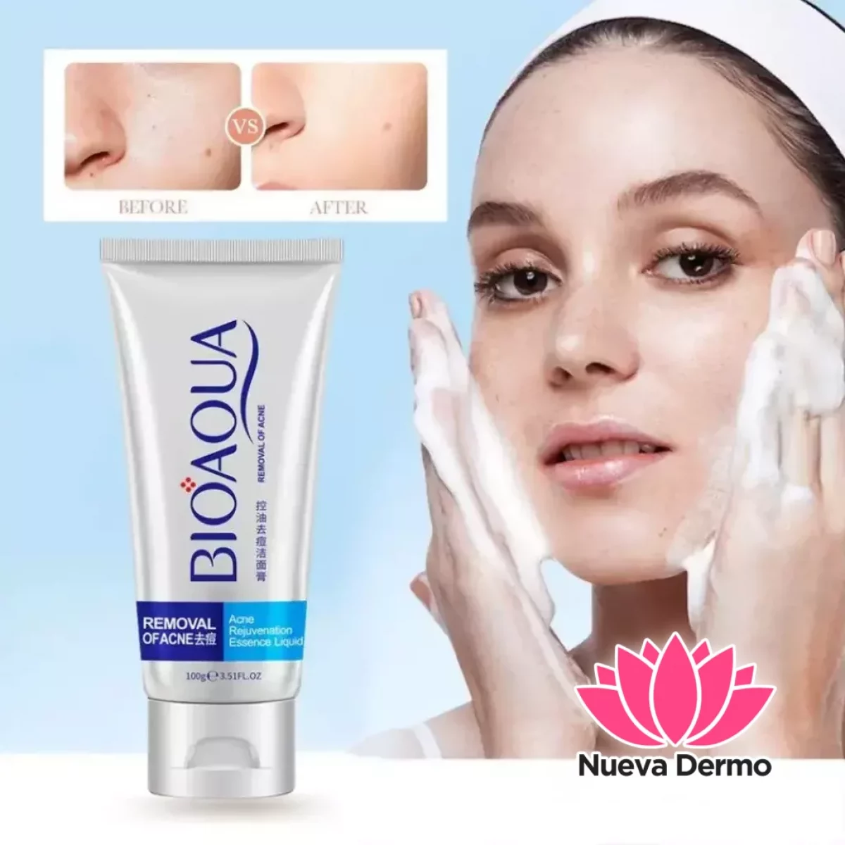 Gel limpiador espuma para acné 100G(Bioaqua)