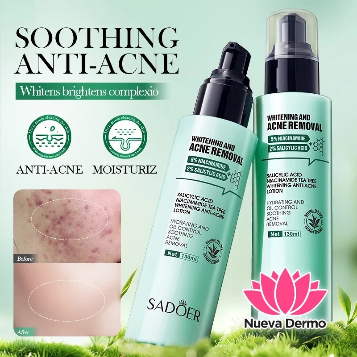 Lotion Aclarante Antiacné con Ácido Salicílico Niacinamida y Árbol de Té 130 Ml 84095