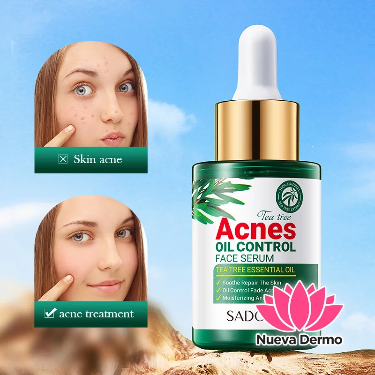 Sérum Antiacné y Control Grasa con Árbol de Té