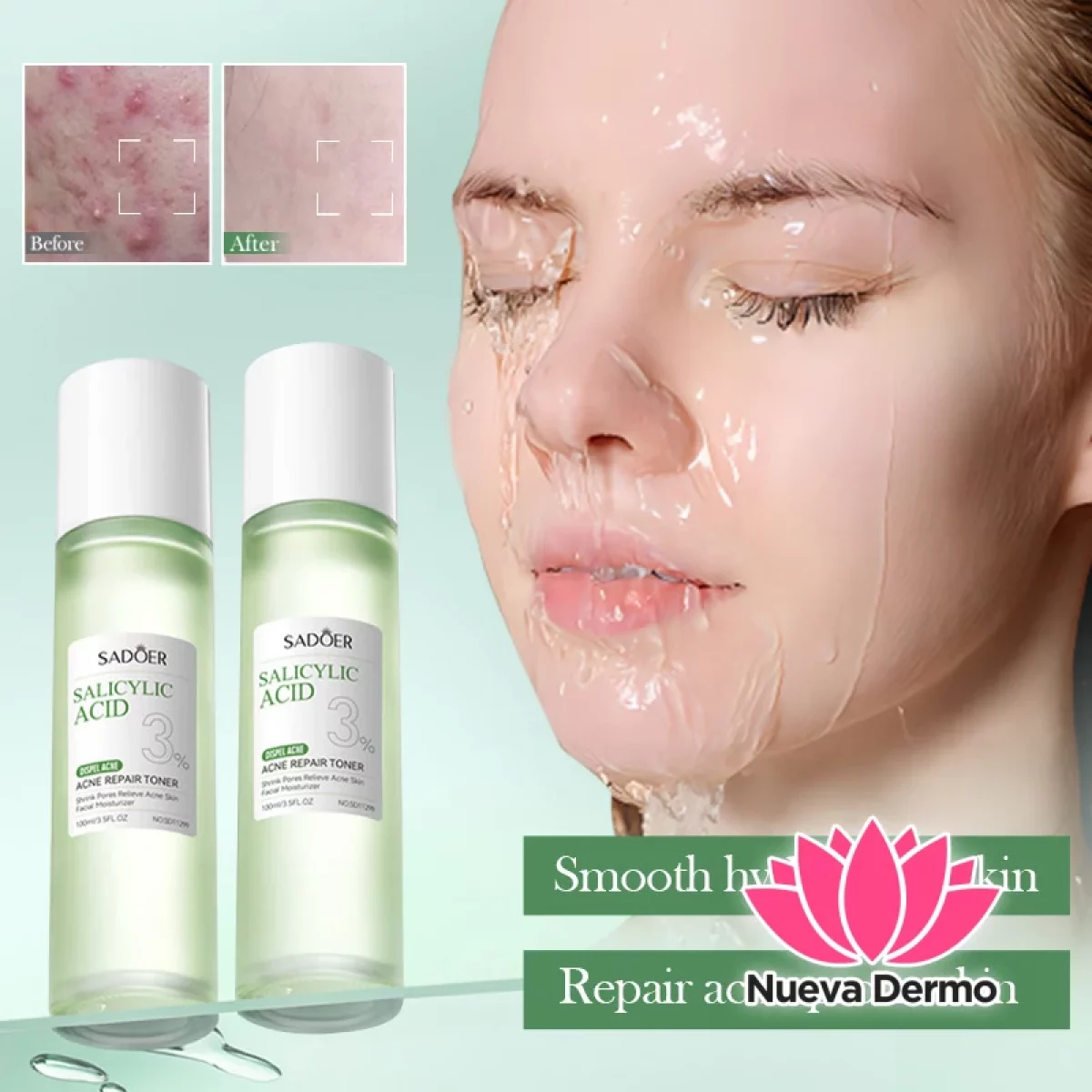 Toner Agua Tónico con Aminoácidos Anti-Acne y Ácido Salicílico