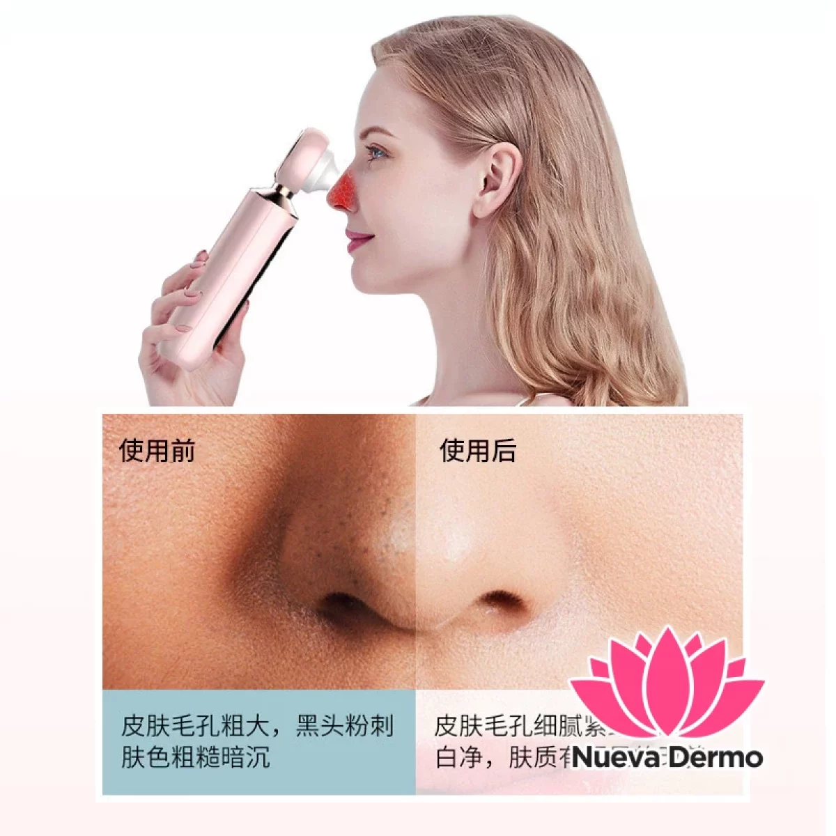 visual blackhead instrument 6956897023063